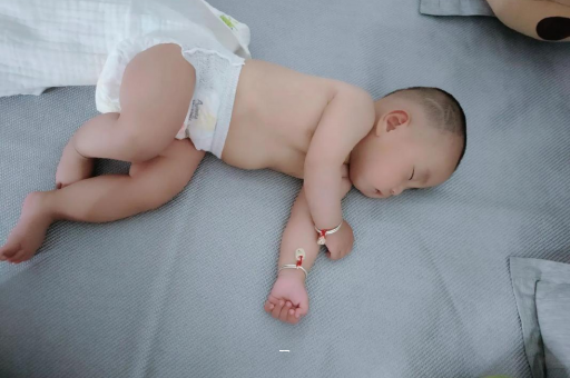 新昌宝宝脸上有白色斑块